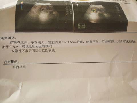 journal_insert_pic_1153511337