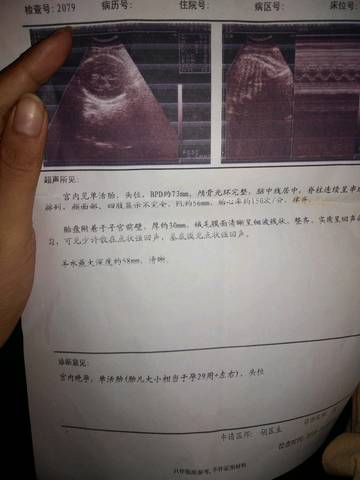 journal_insert_pic_1155536971