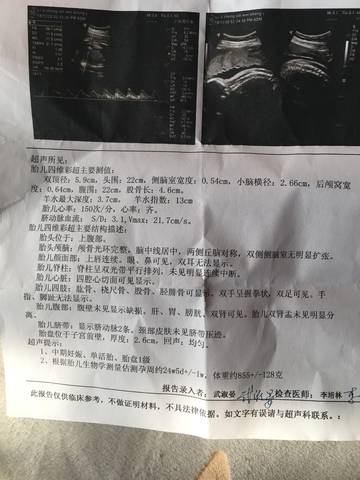 journal_insert_pic_1155434682
