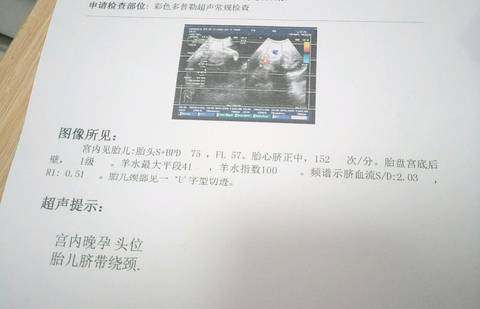 journal_insert_pic_1155439154