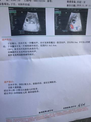 journal_insert_pic_1156093021