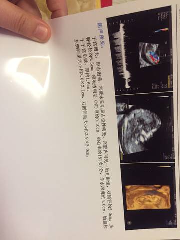 journal_insert_pic_1161145374