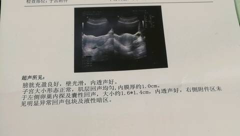 journal_insert_pic_1162079732
