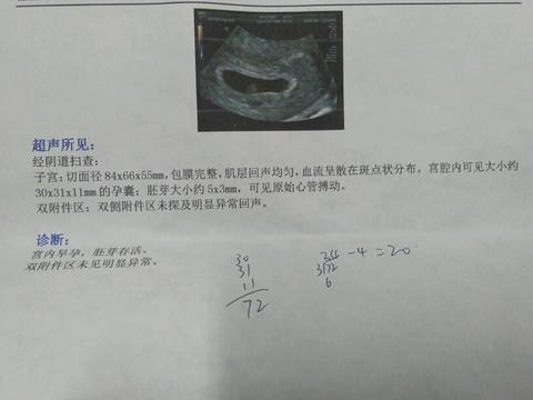 journal_insert_pic_1162763289