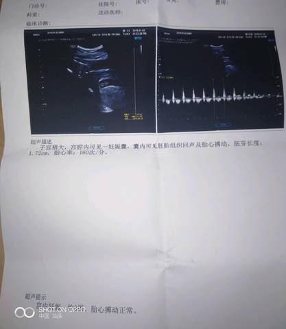 journal_insert_pic_1165938552