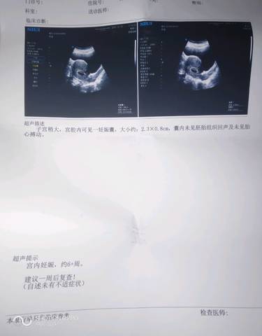 journal_insert_pic_1165938553