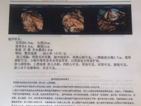 journal_insert_pic_1166628363