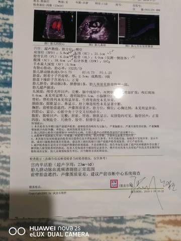 journal_insert_pic_1167035598