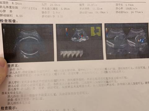 journal_insert_pic_1173547607