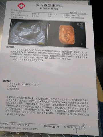 journal_insert_pic_1174430599