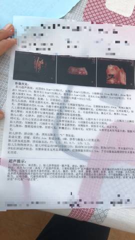 journal_insert_pic_1182810956