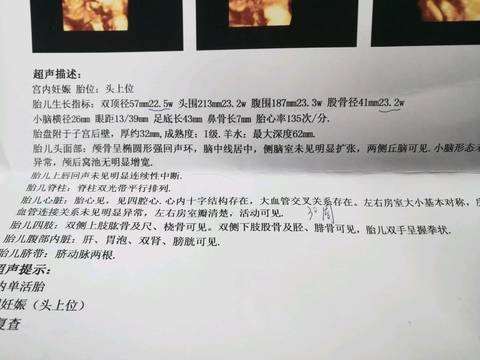 journal_insert_pic_1184337050