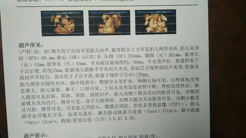 journal_insert_pic_1189240977