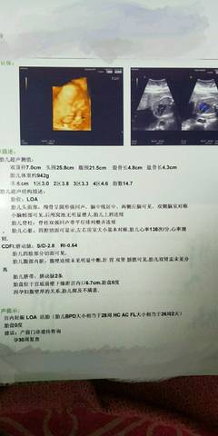 journal_insert_pic_1190051064