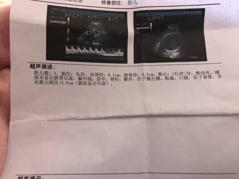 journal_insert_pic_1190584756