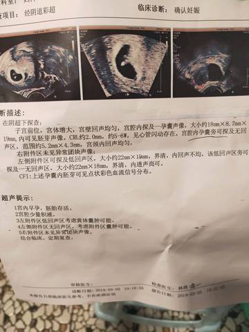 journal_insert_pic_1193432314