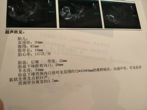 journal_insert_pic_1194320943