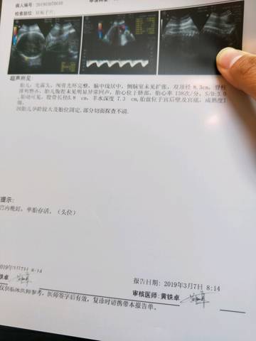 journal_insert_pic_1194221862