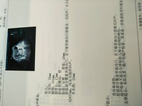 journal_insert_pic_1194320956