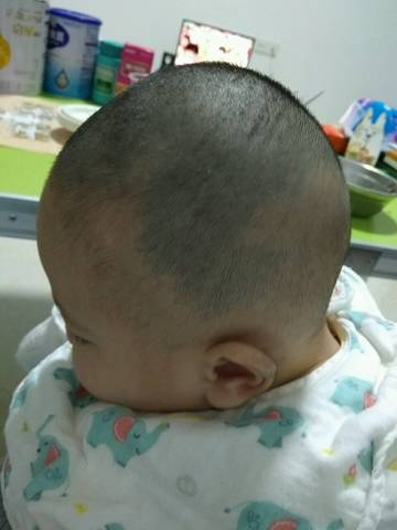 【变形记】扁头偏头变圆头