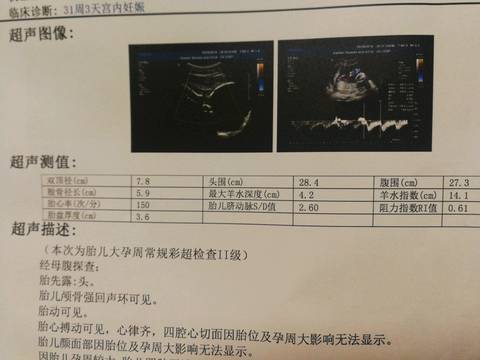 journal_insert_pic_1196205115