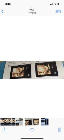 journal_insert_pic_1199843456