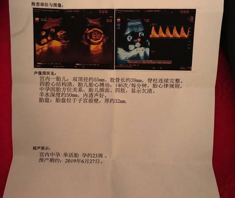 journal_insert_pic_1199813335