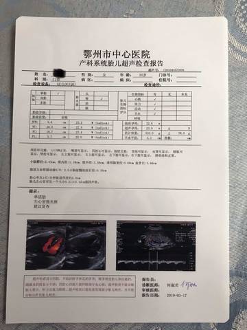 journal_insert_pic_1199902349