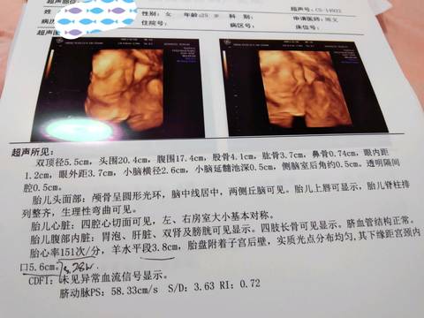 journal_insert_pic_1203247517