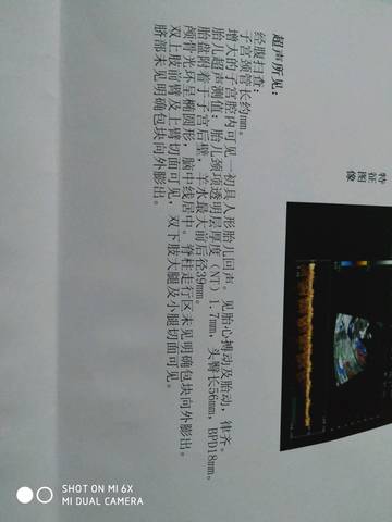 journal_insert_pic_1204082686