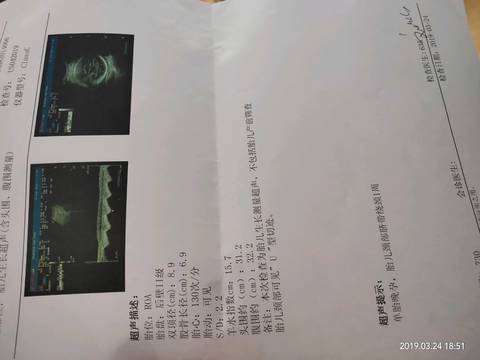 journal_insert_pic_1203941019