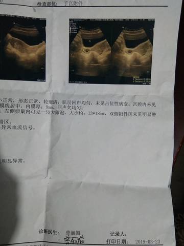 journal_insert_pic_1204376555