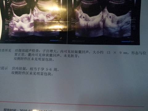 journal_insert_pic_1204251137