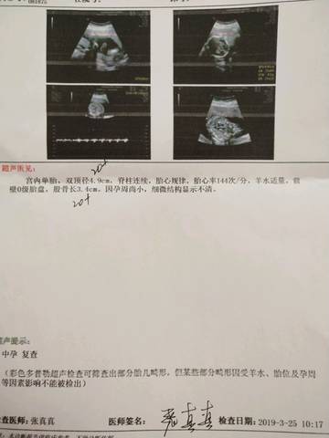 journal_insert_pic_1205447649