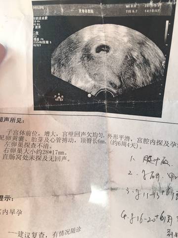 journal_insert_pic_1206033589