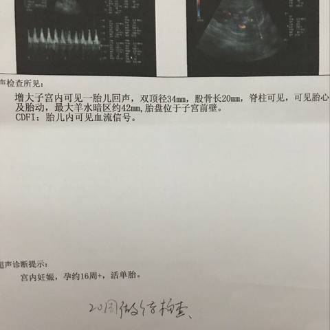 journal_insert_pic_1206853545