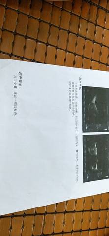 journal_insert_pic_1207848184