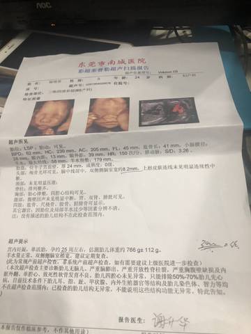 journal_insert_pic_1209125676