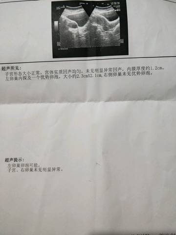 journal_insert_pic_1211489464