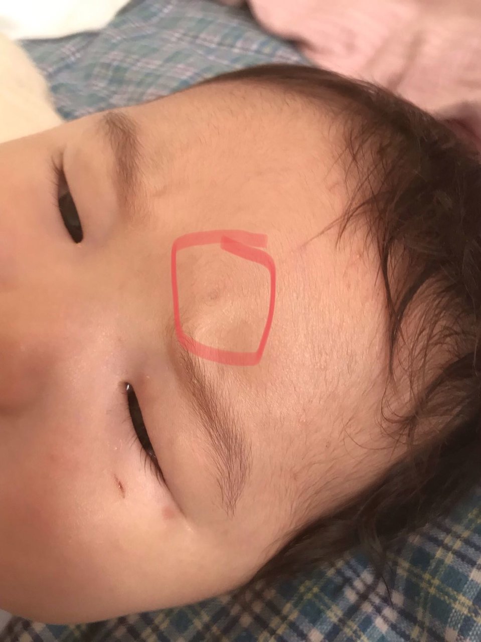 宝宝头上长两个旋好不好？眉毛上方也有一个？