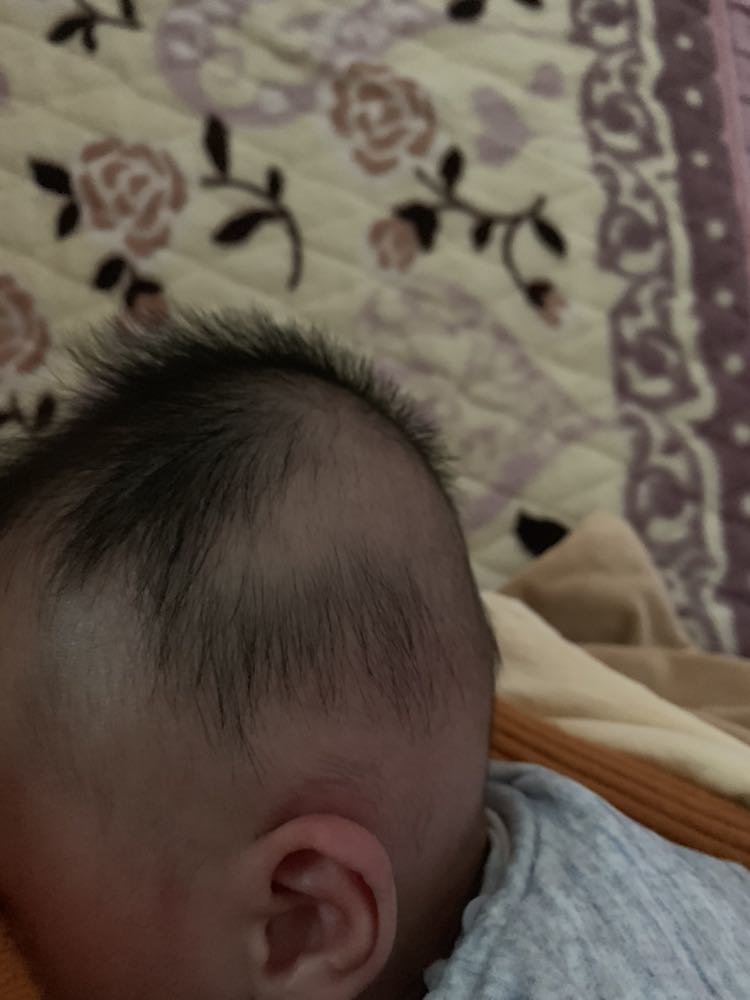 头型丑丑的，后脑勺还有点凹不知道怎么回事
