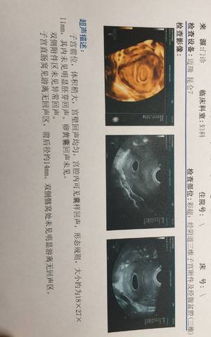 journal_insert_pic_1216433702