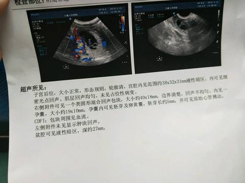 journal_insert_pic_1217255487