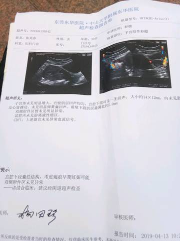 journal_insert_pic_1217802711