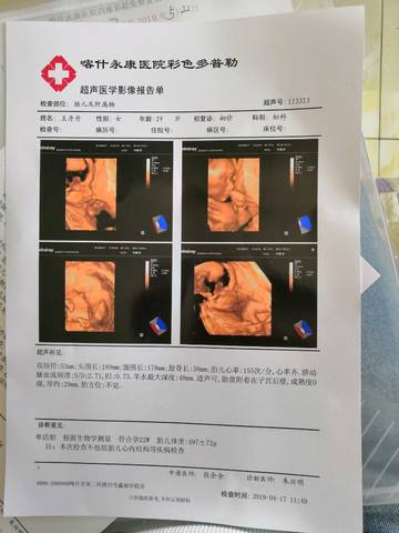 journal_insert_pic_1218313229