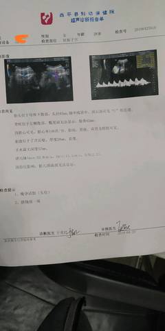 journal_insert_pic_1224438771