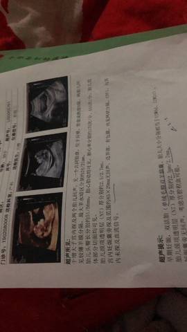 journal_insert_pic_1228602061