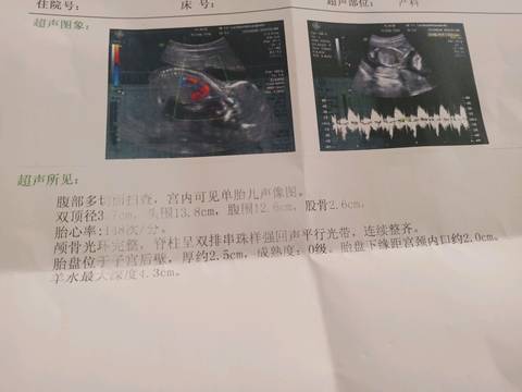 journal_insert_pic_1228824079