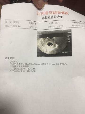 journal_insert_pic_1228783889