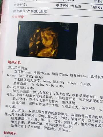 journal_insert_pic_1229018793